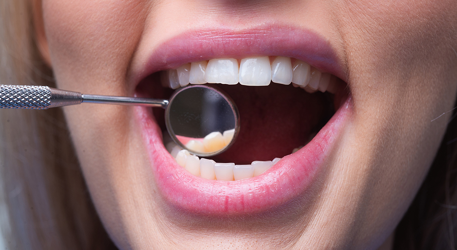 The Role of Dental Crowns in Restorative Dentistry: More Than Just a Cosmetic Fix