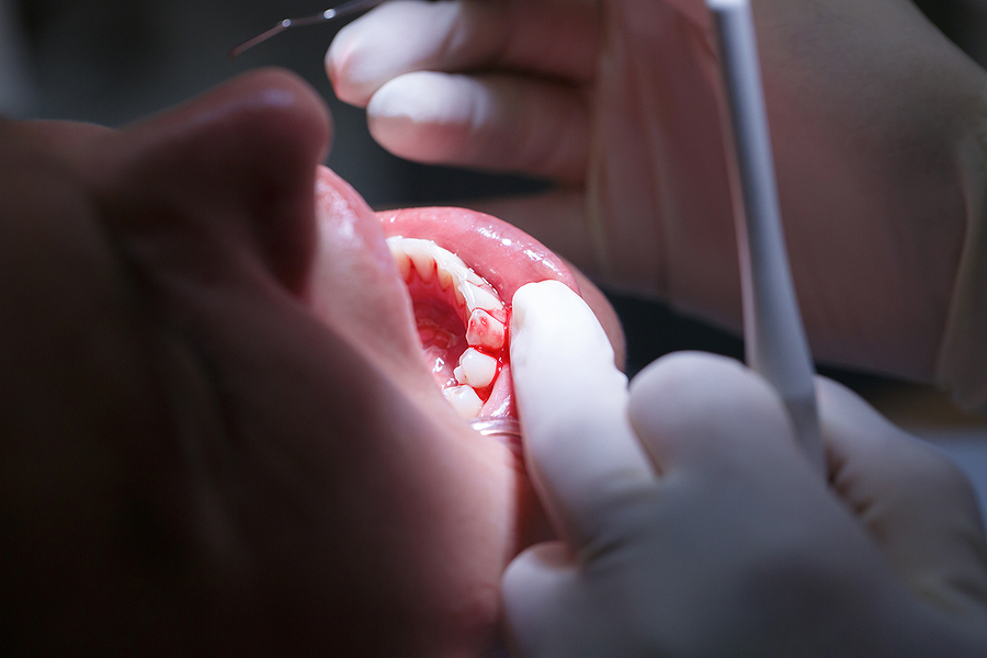 Understanding Periodontics: The Key to Healthy Gums and Teeth
