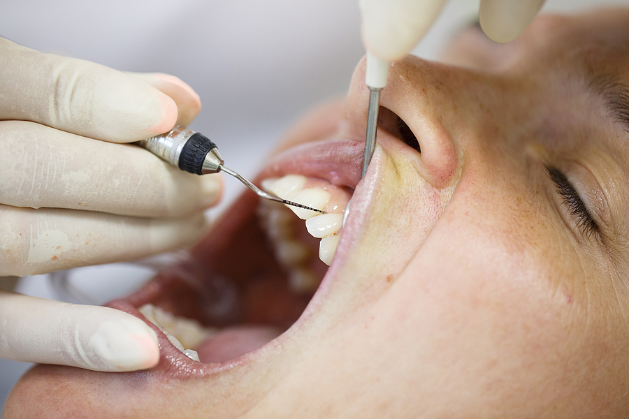 Comprehensive Care for Your Gums: Periodontics in Royal Oak, MI